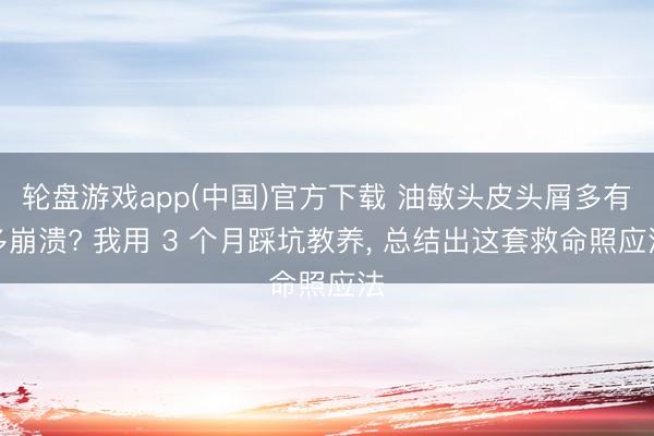 轮盘游戏app(中国)官方下载 油敏头皮头屑多有多崩溃? 我用 3 个月踩坑教养， 总结出这套救命照应法